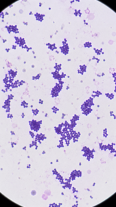 Gram Positive Cocci – Staphylococcus