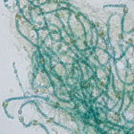 Nostoc Colony Under Microscope