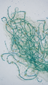 Nostoc Colony Under Microscope