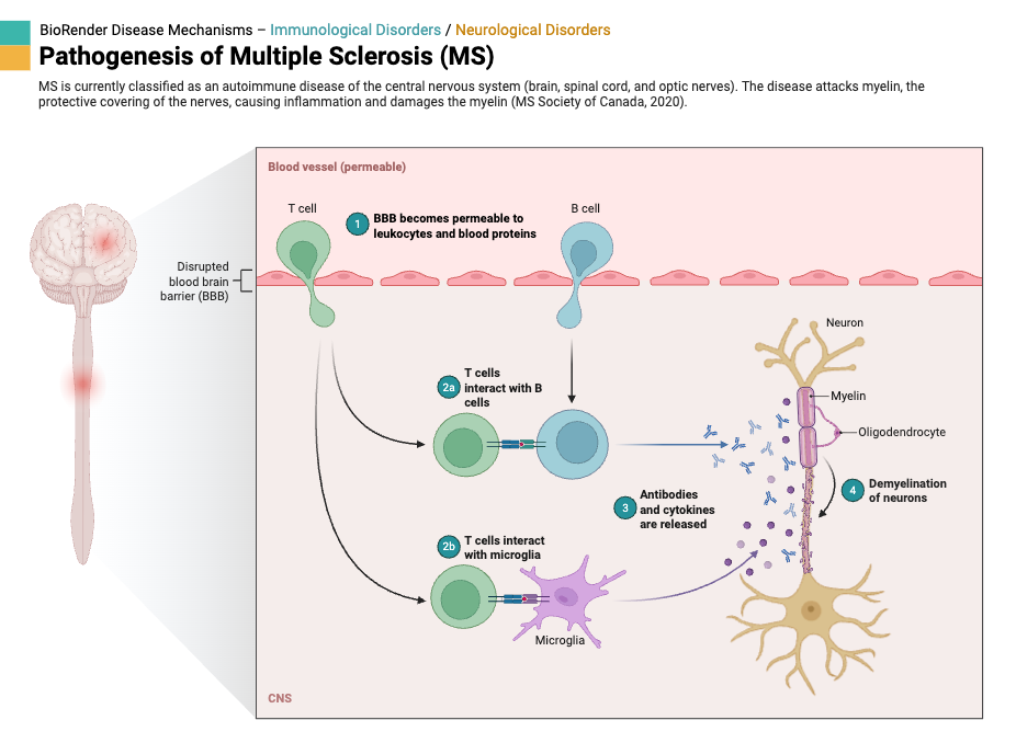Autoimmune Disease - Definition, Types, Diagnosis, Treatment, Examples 8 Pathogenesis of Multiple Sclerosis (MS)