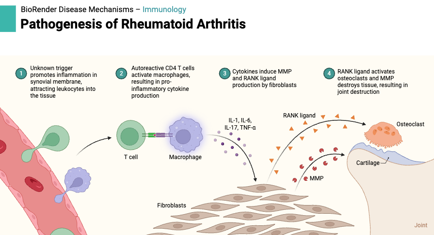 Autoimmune Disease - Definition, Types, Diagnosis, Treatment, Examples 6 Pathogenesis of Rheumatoid Arthritis