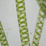 Spirogyra Under Microscope