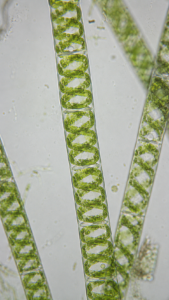 Spirogyra Under Microscope
