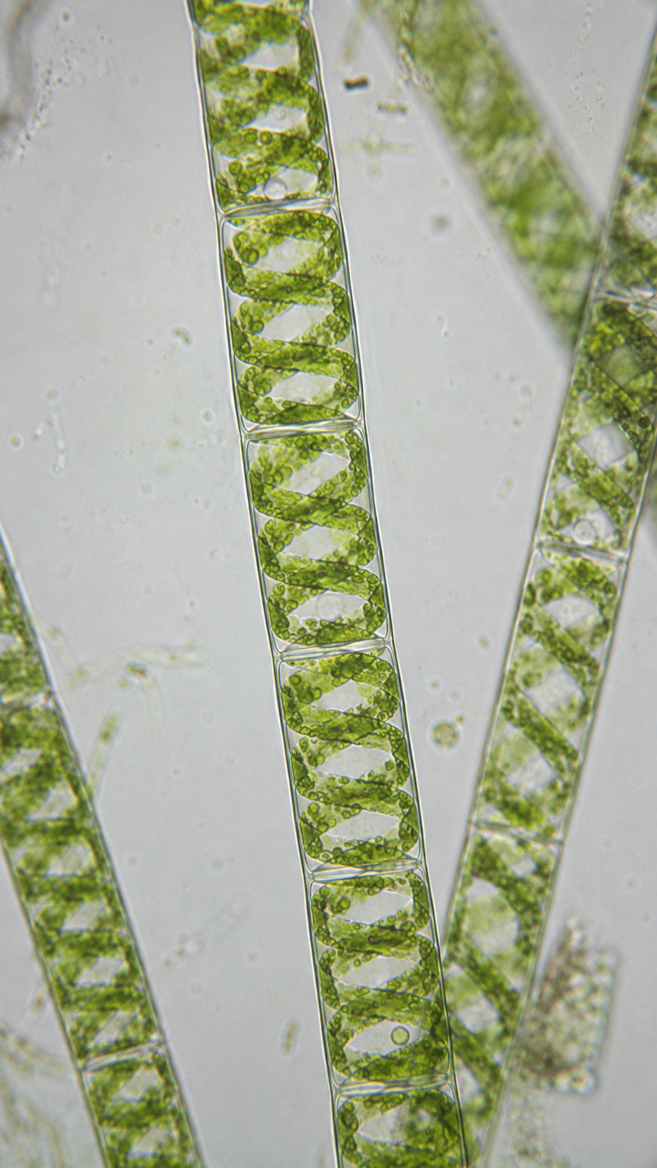 Spirogyra Under Microscope