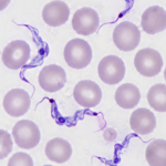 Trypanosoma in Blood Smear