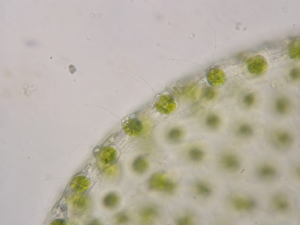 Individual green Volvox somatic cells on the colony surface at 1000× oil immersion