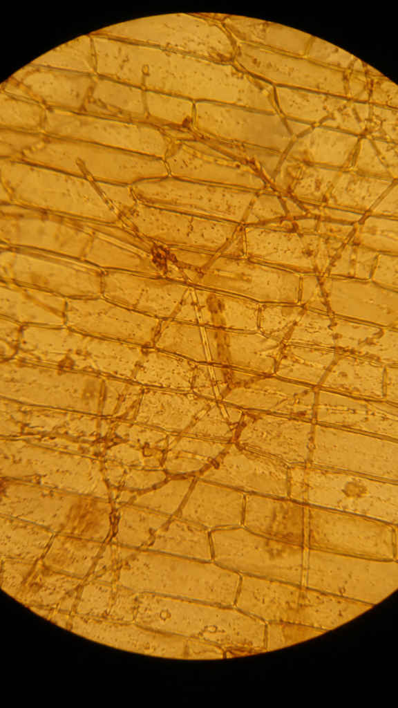 Microscopic view of onion peel cells showing fungal hyphae growing-100x