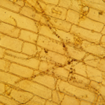 Microscopic view of onion peel cells showing fungal hyphae growing -400x